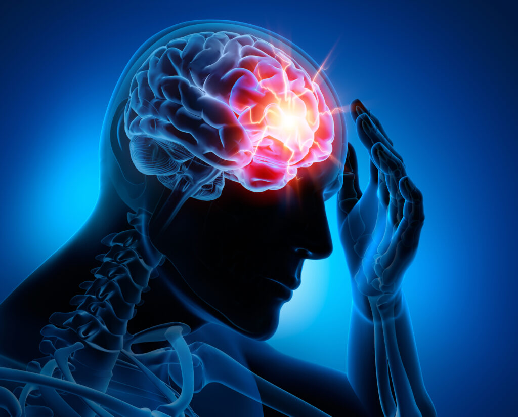 Concussion & Memory Loss Claims - Chicago Personal Injury Attorneys ...
