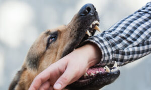 Why Call Zayed Law Offices Personal Injury Attorneys for Legal Assistance With a Dog Bite Injury Claim?